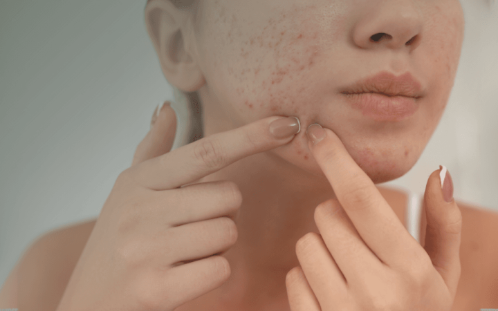 ‘DEFNEDEN ile özgürleş’ (2)